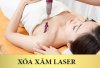 gia-tay-xoa-hinh-xam-laser-bao-nhieu-tien-747.jpg